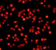 NB110-57460 - Retinoblastoma-associated protein / RB1