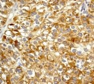 NB110-57464 - Rho