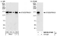NB100-57495 - ATAD5
