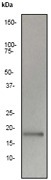 NB110-57621 - TNF-beta / Lymphotoxin-alpha