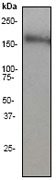 NB110-57623 - TOP2A