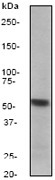 NB110-57629 - Tryptophan 5-hydroxylase 1 (TPH1)