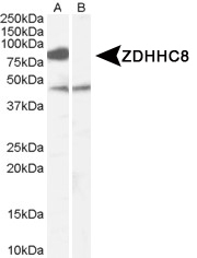 NB100-57849 - ZDHHC8