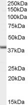 NB100-57850 - ABHD5