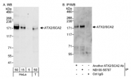 NB100-58797 - Ataxin-2