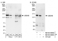 NB100-58802 - UBE4B