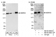 NB100-58830 - WDR33
