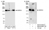 NB100-58831 - WDR33