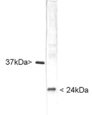 NB110-58872 - UCHL1 / PGP9.5