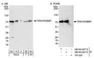 NB100-59772 - TRIM16