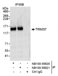 NB100-59820 - TRIM37