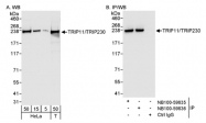 NB100-59835 - TRIP11