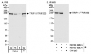 NB100-59836 - TRIP11