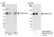 NB100-59841 - TRIM47 / RNF100