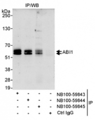 NB100-59845 - ABI1 / SSH3BP1