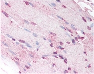 NB110-60002 - Defensin alpha 5