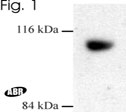 NB120-3458 - Dynamin-3