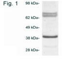 NB120-3466 - Biliverdin reductase A
