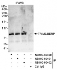 NB100-60400 - TRIM3 / BERP