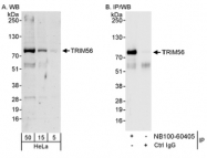 NB100-60405 - TRIM56 / RNF109