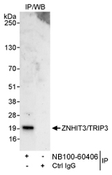 NB100-60406 - ZNHIT3