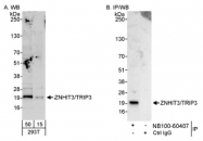 NB100-60407 - ZNHIT3