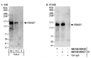NB100-60426 - RBM27