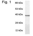 NB120-3504 - Transducin alpha-1 chain / GNAT1