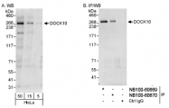 NB100-60670 - DOCK10