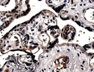 NB110-60975 - VEGF-A