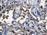 NB110-60996 - Erythropoietin / EPO