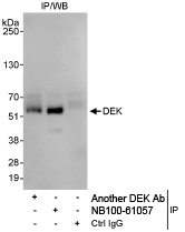 NB100-61057 - DEK