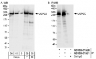 NB100-61591 - USP9X