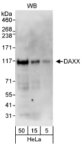 NB100-61592 - DAXX