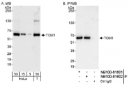 NB100-61602 - TOM1