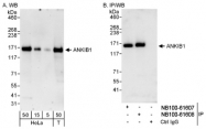 NB100-61608 - ANKIB1