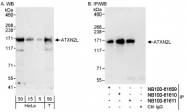 NB100-61609 - Ataxin-2-like protein