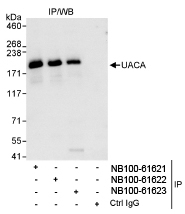 NB100-61622 - UACA