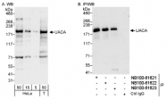 NB100-61623 - UACA