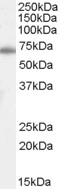 NB100-61659 - XRCC6 / Ku70