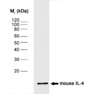 NB100-64798 - Interleukin-4 / IL4