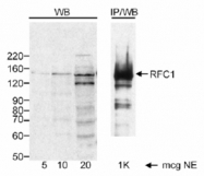 NB600-961 - RFC1 / RFC140