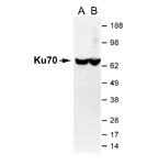 NB100-335 - XRCC6 / Ku70