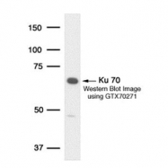 NB100-349 - XRCC6 / Ku70