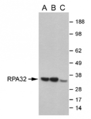 NB100-347 - RPA2