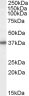 NB100-68164 - BPNT1