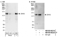 NB100-68219 - ZHX3