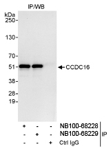 NB100-68228 - ZNF830 / CCDC16