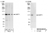 NB100-68233 - SART1