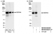 NB100-68251 - WDR44 / Rabphilin-11